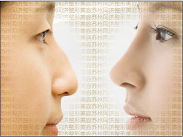 拆線(xiàn),隆鼻,注意事項,假體