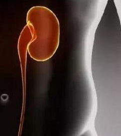 腎功能檢查前有哪些注意事項