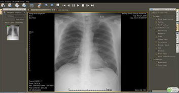 醫學(xué)影像基礎概論前五章知識點(diǎn)